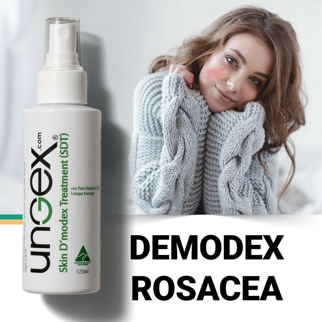 Treat Demodex Infestation Hair Face Body Demodicosis Mites Acne Rosacea ...